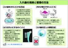 入れ歯の清掃と管理の方法